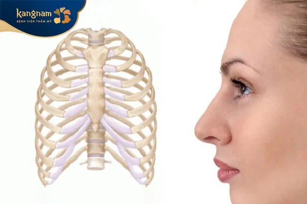 Nâng mũi sụn sườn duy trì được hiệu quả vĩnh viễn