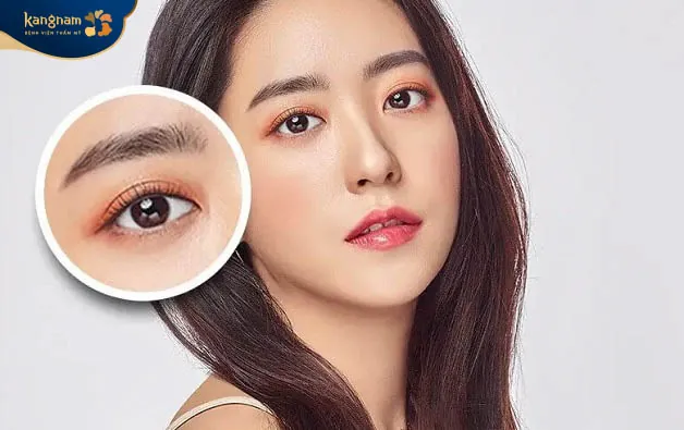 nhấn mí giá rẻ có thể dẫn đến nhiều biến chứng