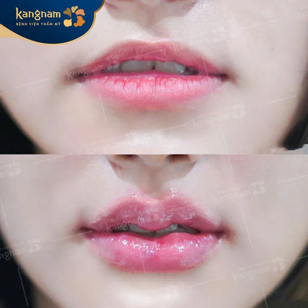 Môi trái tim sở hữu đường cong mềm mại, cân đối hài hòa