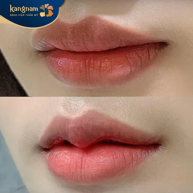 Môi tim xinh, tạo điểm nhấn cho gương mặt