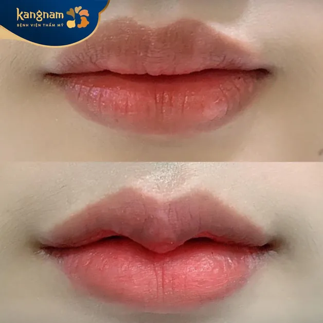 Môi trái tim khắc phục mọi khuyết điểm, tạo điểm nhấn đặc biệt cho gương mặt