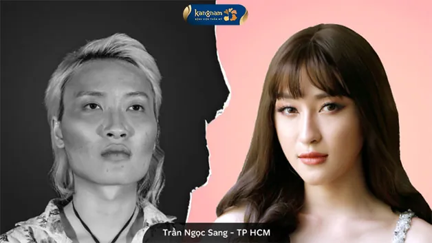 Gương mặt baby với dáng cằm V-line thanh thoát, đầy quyến rũ