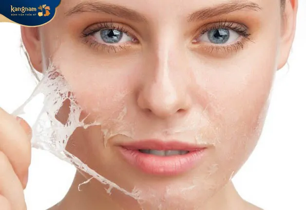 Ứng dụng công nghệ cao trị đốm nâu