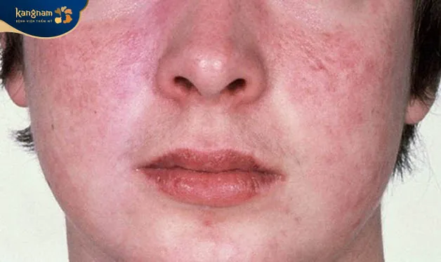 Sử dụng hoạt chất không phù hợp