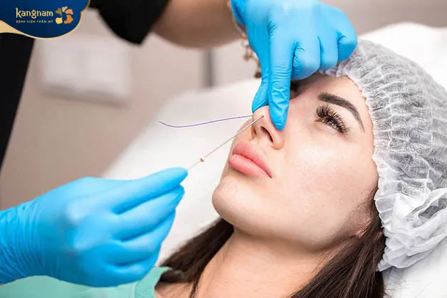 Phương pháp nâng mũi này được đánh giá tốt và an toàn