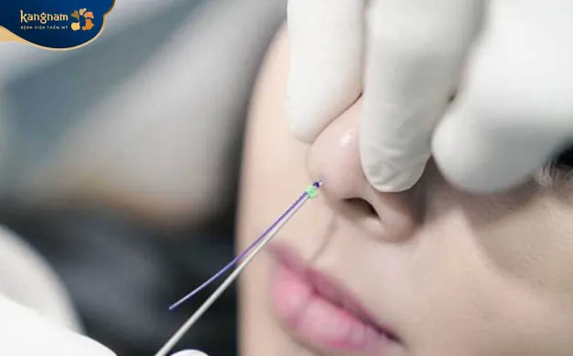 Không duy trì được hiệu quả lâu dài