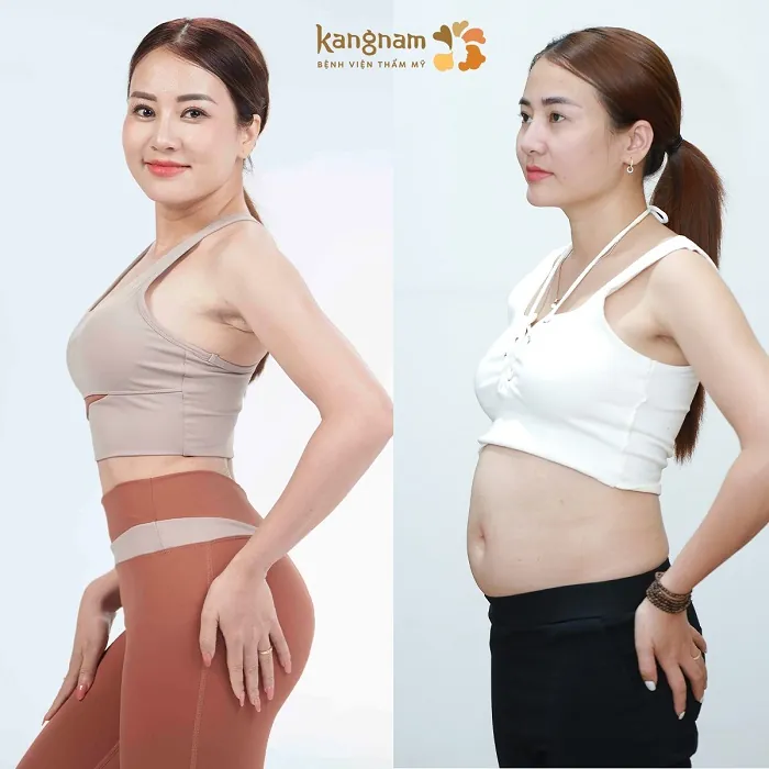 Vóc dáng thon gọn cân đối với dịch vụ thẩm mỹ chất lượng cao