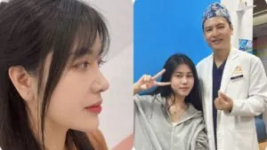 Kinh nghiệm nâng mũi thực tế: Những điều nên biết trước – trong – sau khi làm