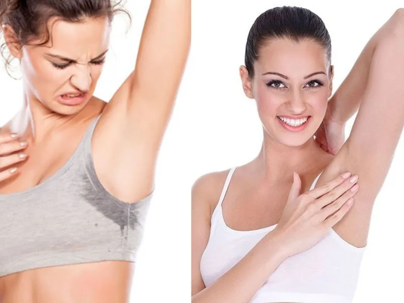 Đánh bay mùi hôi nách sau khi điều trị tại Kangnam TP.HCM