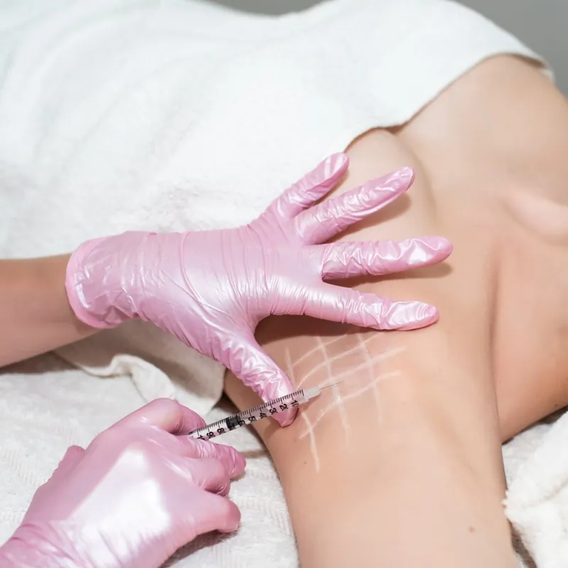 Tiêm Botox trị hôi nách hiệu quả nhanh 